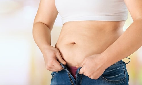 Package for Tummy Tuck With Liposuction of Abdomen and Waist