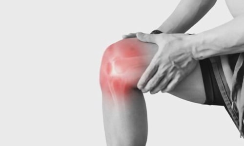 Pacote para artroscopia diagnóstica do joelho