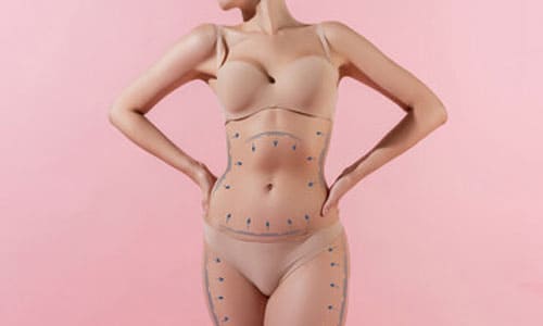 Paket für Mommy Makeover mit Tummy Tuck Brustvergrößerung mit Fett und Fettabsaugung von Bauch und Taille