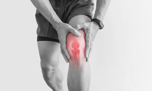 Médecins proposant le remplacement du genou