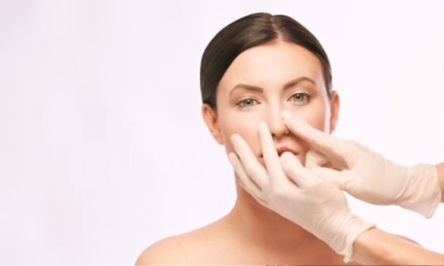 Package for Rhinoplasty