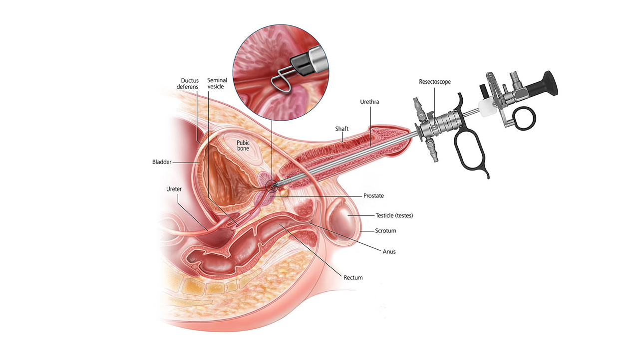 Chirurgie urologică - Medpark