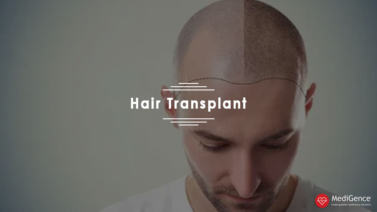 Hair Transplant Cost in India: Hospitals, Success Rate & Reviews